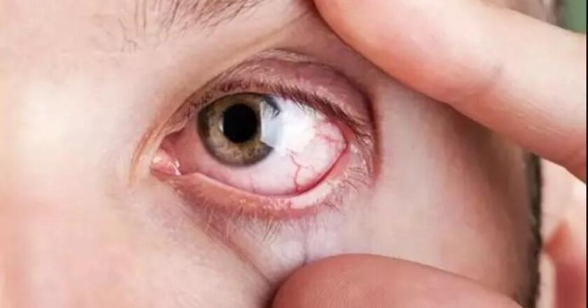 40’tan fazla olan herkes, gözlerin kan basıncına karşı düzenli bir sınav olmalıdır