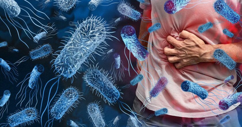 Gıda zehirlenmesi vakaları artıyor! Uzmandan Kritik Uyarılar: Bu Hataları Yapmayın!